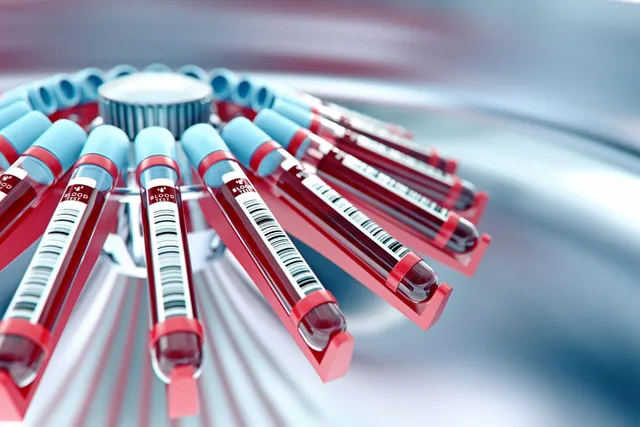 Choosing Your Lab’s Centrifuge